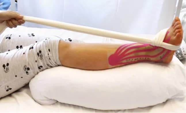 Co oznacza elewacja operowanej kończyny: praktyczne zasady unoszenia nogi